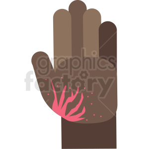 african american burned cartoon hand vector icon