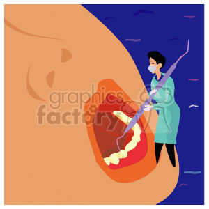   This clipart image depicts a stylized representation of a dentist at work, performing a dental procedure or checkup. The dentist, wearing a mask and gloves for hygiene, is shown with an oversized dental tool inside a patient